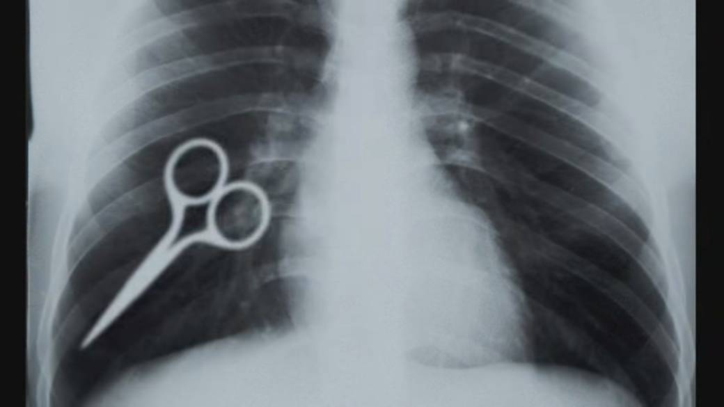 ERRORS IN SURGERY YOU SHOULD KNOW! #1 Best Attorney in Las Vegas Ryan Alexander